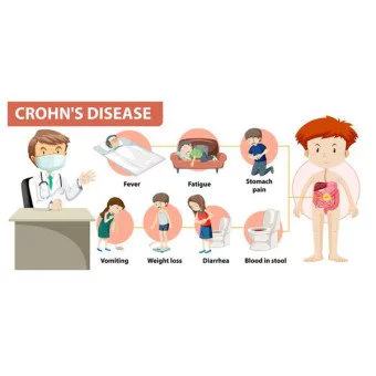 ΝΟΣΟΣ ΤΟΥ CROHN