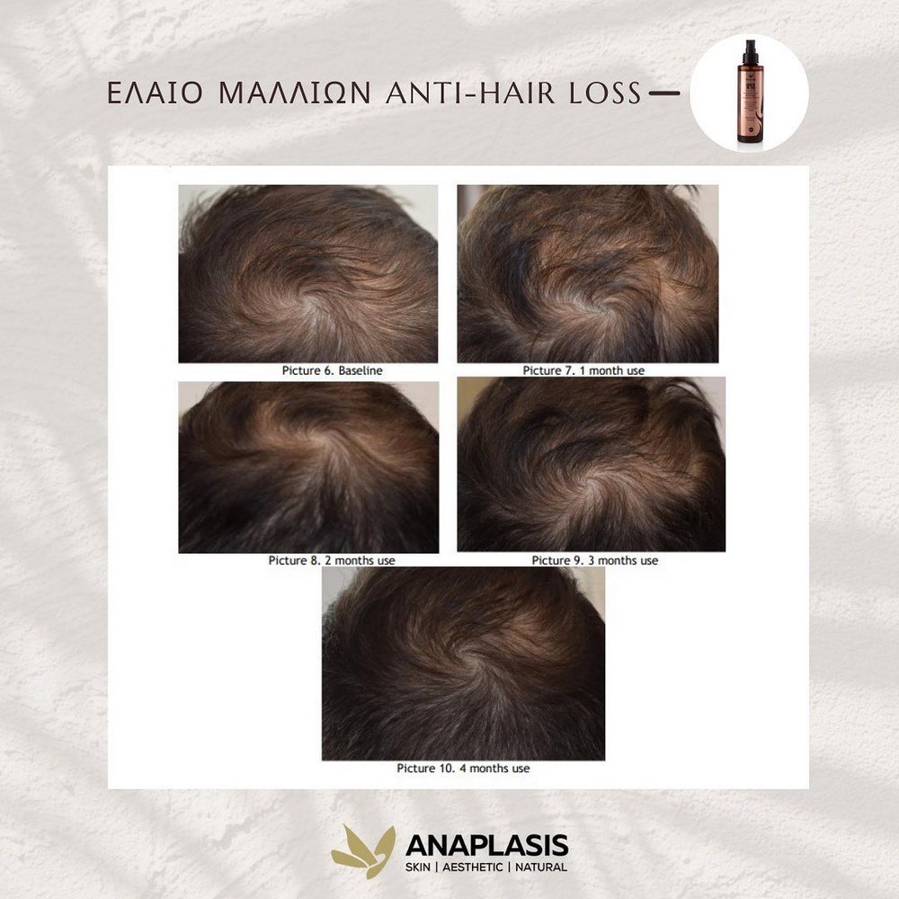 Anaplasis Έλαιο Μαλλιών Anti-Hair Loss RPNZL, 100ml