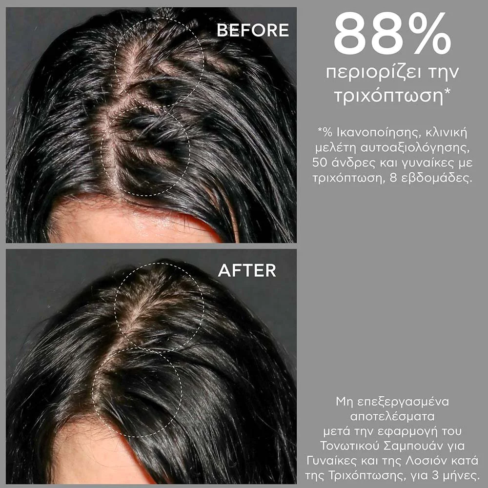 Apivita Women's Tonic Shampoo EcoPack Τονωτικό Σαμπουάν κατά της Τριχόπτωσης για Γυναίκες με Hippophae TC & Δάφνη, 500ml
