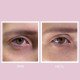 Youth Lab Peptides Spring Hydra-Gel Eye Patches Αντιρυτιδική & Συσφικτική Μάσκα Ματιών, 30 τεμ