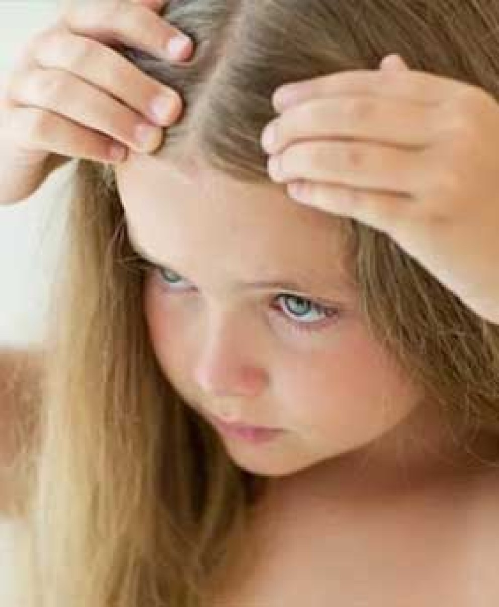 Tips για την Πρόληψη και την Εξάλειψη των Ψειρών
